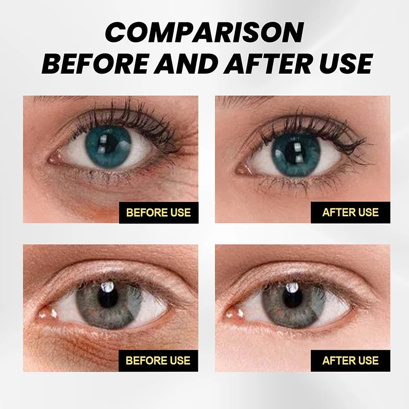 Instant Wrinkle Removal Eye Cream Lifting Firming Eye Cream Anti Aging Moisturizing Remover Dark Circle Eye Care Beauty Health