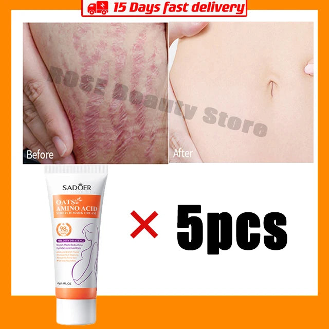 Stretch Marks Permanent Removal Cream Eliminate Body Belly Stretch Marks Swelling Marks Remove Skin Cracks Repair Firming Care