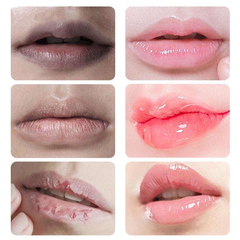 Fast Lightening Lips Pink Cream Fresh Treatment Remove Dark Smoke Lips Lip Balm Moisturizer Nourish Essence