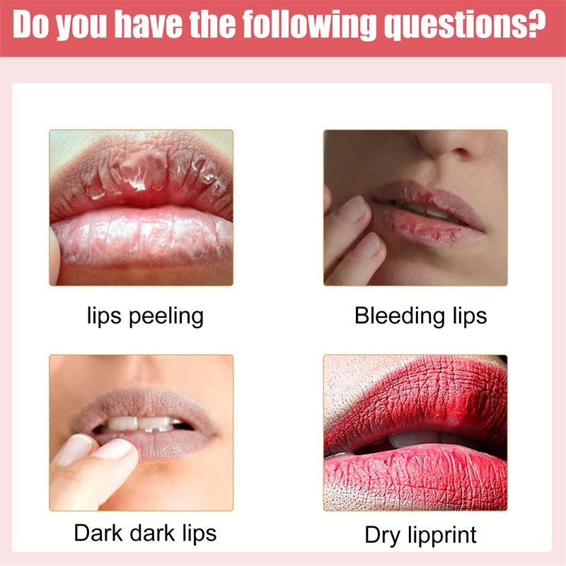 Lips Cream Fresh Pink Bleaching Treatment Remove Dark Smoke Lips Lip Balm Whitening Moisturizer Nourish Essence Dilute Melanin