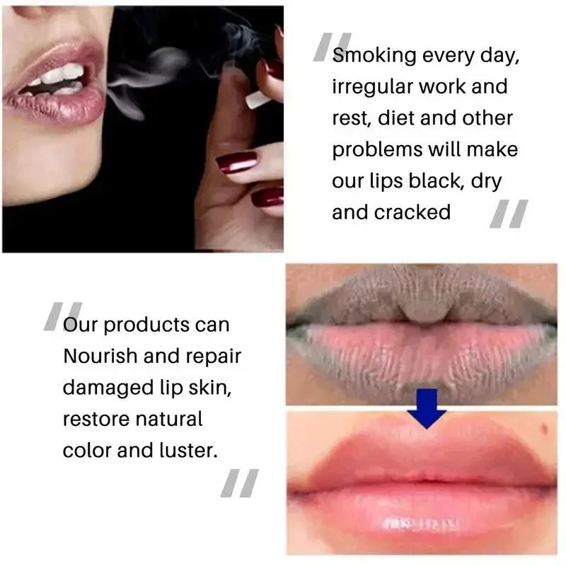 Sale!! Instantly Lip Balm Remove Dark Lighten Melanin Lip Mask Fade Lip Line Brighten Exfoliating Moisturize Dead Skin Repair Lip Care