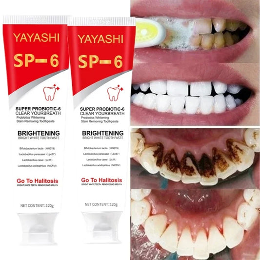 120g Probiotic Toothpaste SP-6 Whitening Tooth Remove Plaque Stains Teeth Whitener Oral Hygiene Clean Fresh Breath Dental