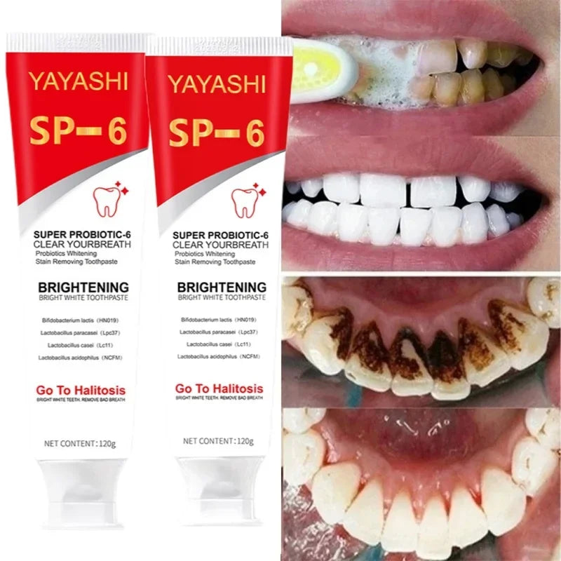 120g Probiotic Toothpaste SP-6 Whitening Tooth Remove Plaque Stains Teeth Whitener Oral Hygiene Clean Fresh Breath Dental