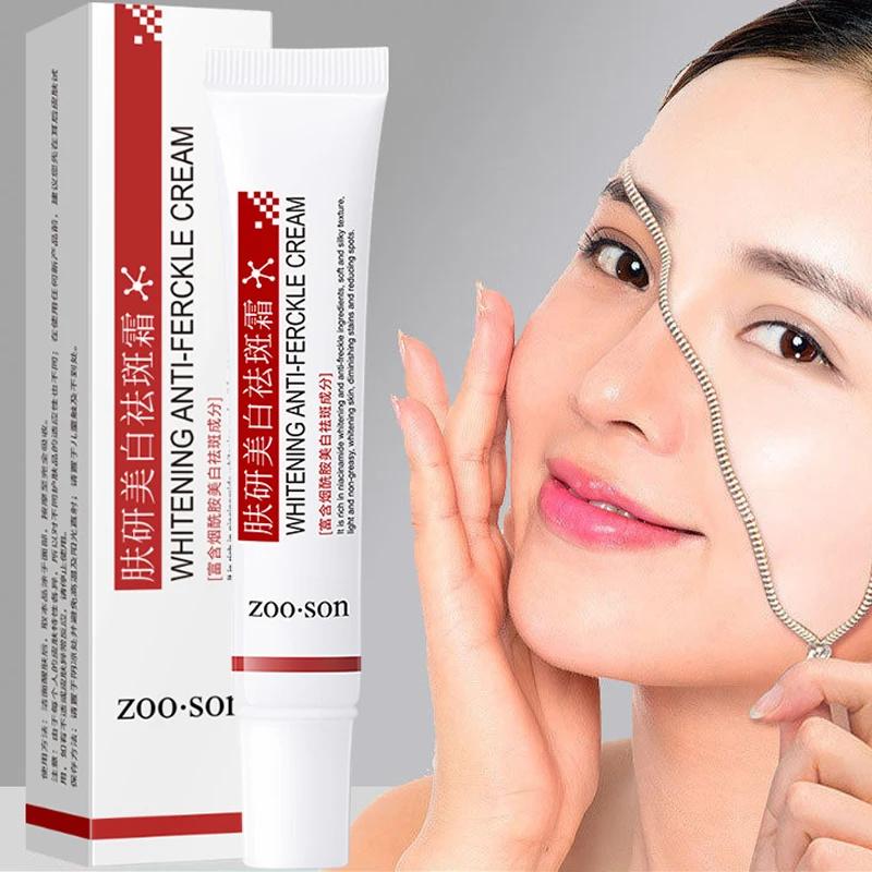 Powerful Spot-removing Whiten Cream Brighten Skin Fast Eliminates Melanin Pigmentation Melasma Dark Spots Moisturize Beauty Gel