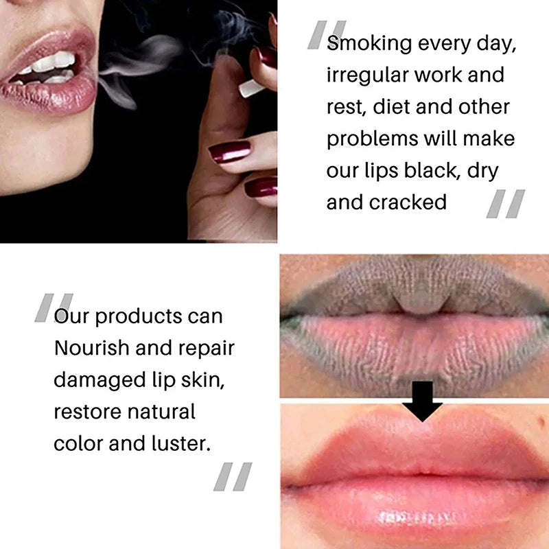 1PC Lips Pink Fresh Lightening BleachingCream Treatment Remove Dark Smoke Lips Lip Balm Whitening Moisturizer Nourishing Essence