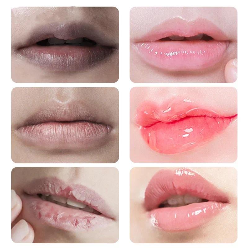 Remove Dark Smoke Lips Pink Fresh Lightening Bleaching Cream Treatment Lip Balm Whitening Moisturizer Nourishing Essence Lips