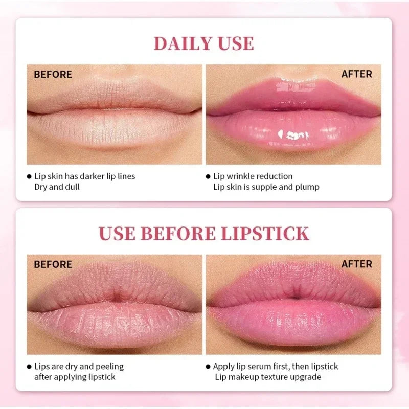 2024 New Lips Bleach Moisturizing Fresh Serum Effective Reduce Pigmentation Pink Whiten Plumper Sexy Lip Balms Korean Cosmetics