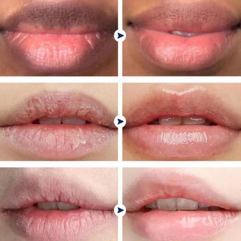 Sale!! Instantly Lip Balm Remove Dark Lighten Melanin Lip Mask Fade Lip Line Brighten Exfoliating Moisturize Dead Skin Repair Lip Care