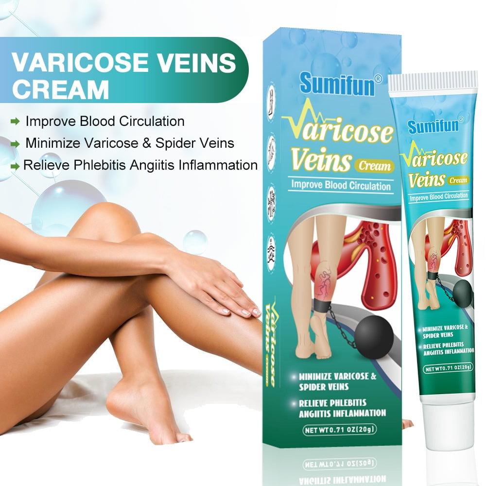 3 Pack Varicose Veins Cream, Soothing Leg Cream with Natural Ingredients Improve Blood Circulation,Relieve Pain of Legs