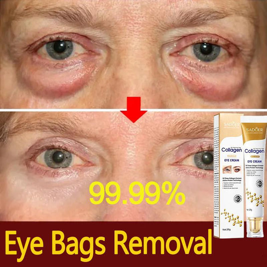 Sadoer Collagen Anti-wrinkle Eye Cream Eye Contour Eye Bags Dark Circles Removal Eye Beauty Cream Serum Korean Cosmetics 20g