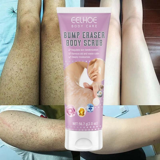Sale!! 7-Day Fast Body Scrub Cream Moisturizing Skin Repair Keratosis Pilaris Removing Strawberry Legs Eraser Nourishing Body Skin Care