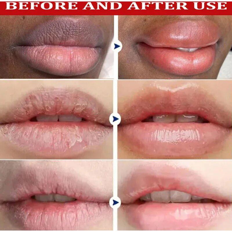 Sale!! Remove Dark Lip Balm Lighten Melanin Keeping Elasticlip Mask Exfoliating Moisturize Dead Skin Repair Korean Lip Care Products