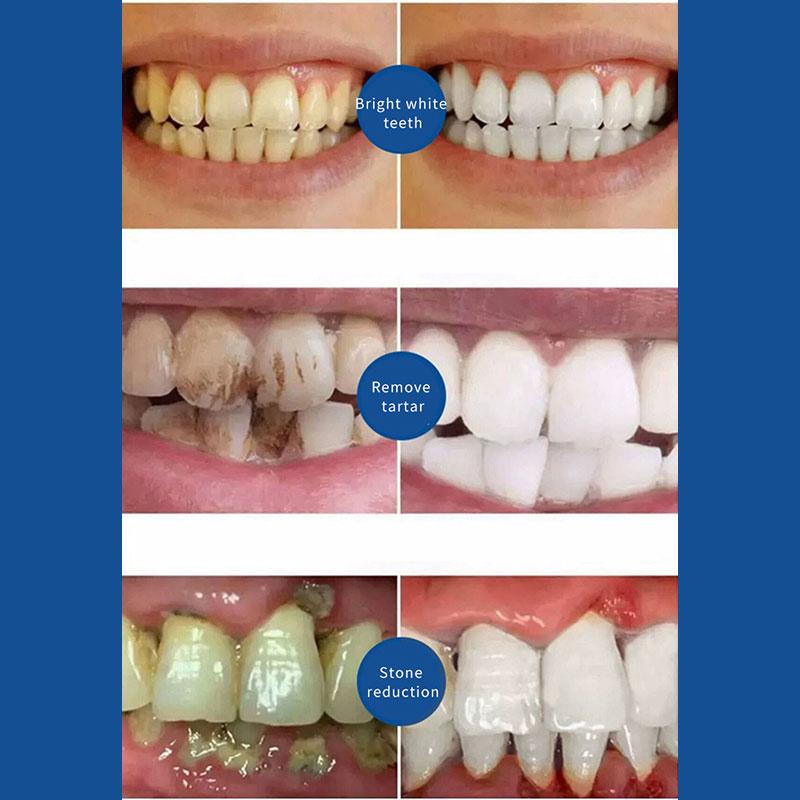 Probiotic Toothpaste SP-4 Whitening Tooth Remove Plaque Stains Teeth Whitener Oral Hygiene Clean Fresh Breath Dental Tools 2024