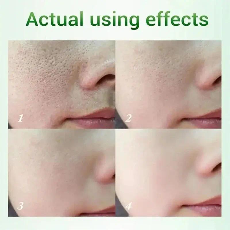Salicylic Acid Pore Shrinking Cream Tighten Face Smooth Skin Korean Care Product 2024 New