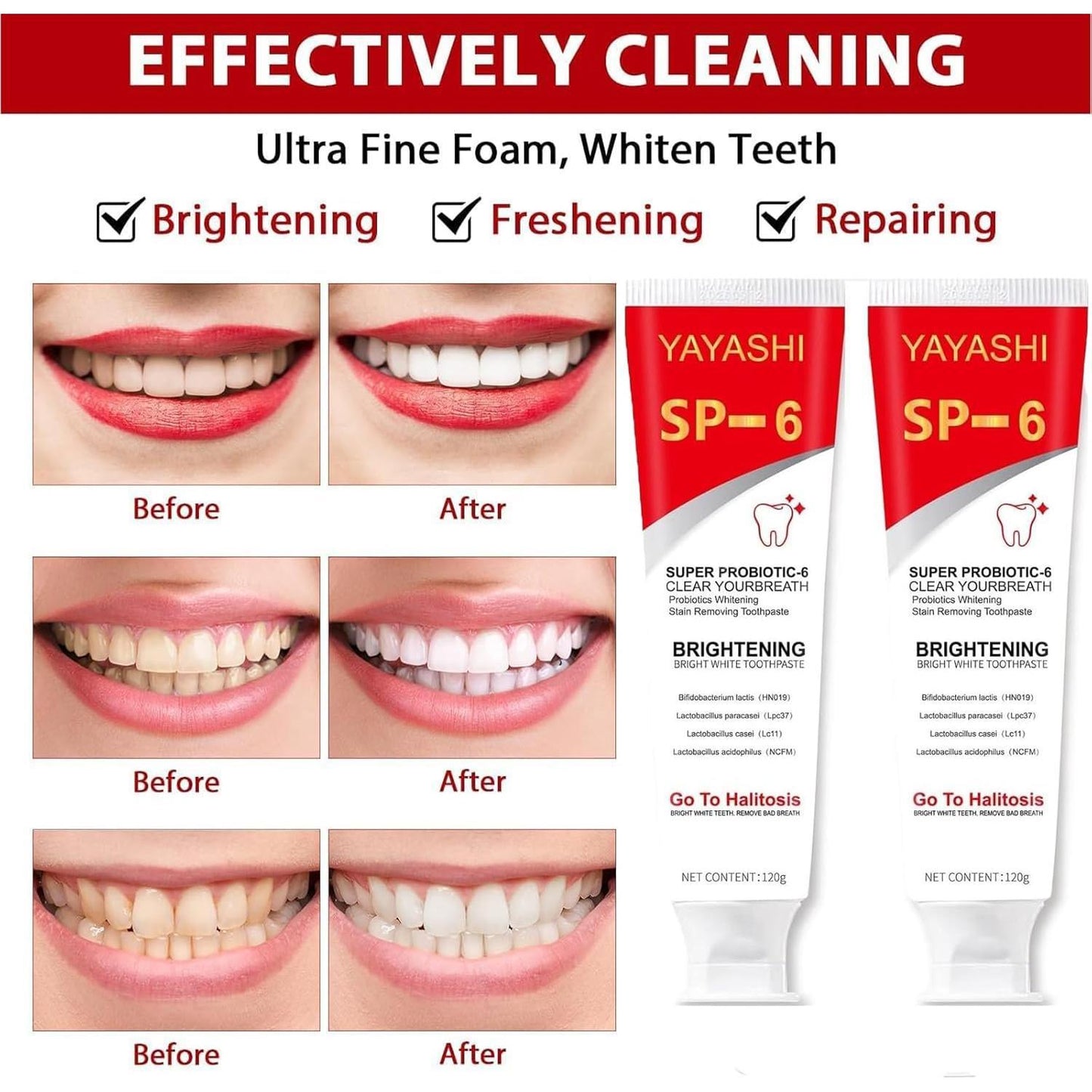 Sp-6 Ultra Whitening Toothpaste,Probiotic Sp-6 Toothpaste,SP 6 Toothpaste,Ultra Whitening Toothpaste Sp-6 (1pc)