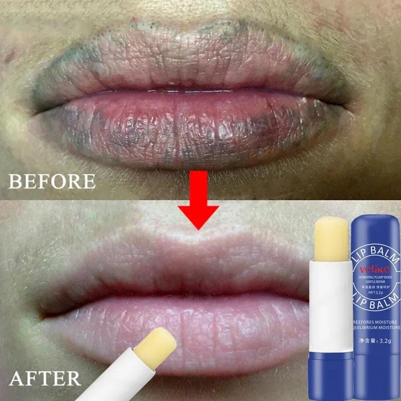 Remove Dark Lip Balm Exfoliating Dead Skin Fade Lip Line Lighten Melanin Lip Mask Moisturizing Brighten Repair Lip Care Product