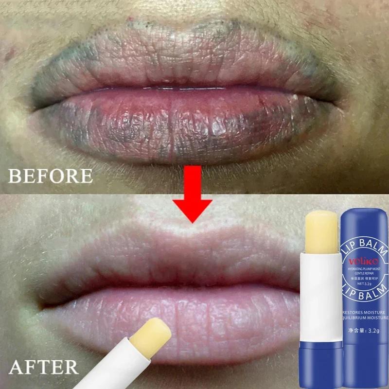 Sale!! Instantly Lip Balm Remove Dark Lighten Melanin Lip Mask Fade Lip Line Brighten Exfoliating Moisturize Dead Skin Repair Lip Care