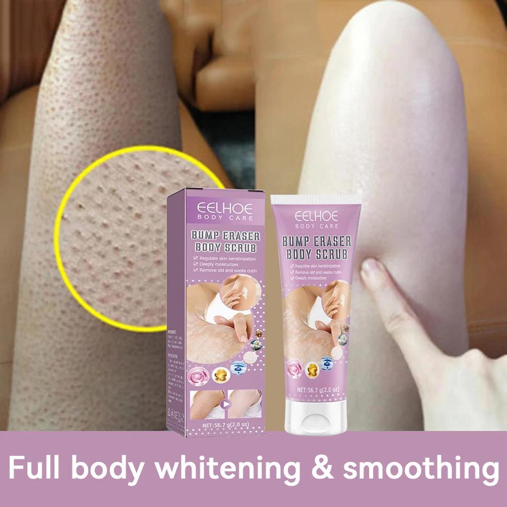 Sale!! 7-Day Fast Body Scrub Cream Moisturizing Skin Repair Keratosis Pilaris Removing Strawberry Legs Eraser Nourishing Body Skin Care