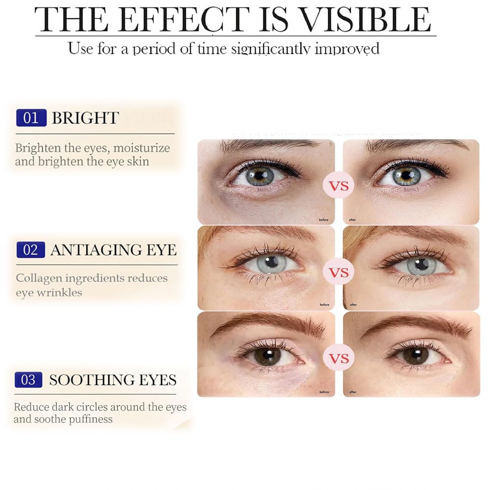 Sale!! Lumineyez Repair Essence Eye Essence,Instant Lumineyez Collagen Anti-Wrinkle Eye Cream,Anti Wrinkle Moisturizing Fine Lines Firming De-Puffiness Dark Circles Anti-Aging Eye Cream (1Pc)
