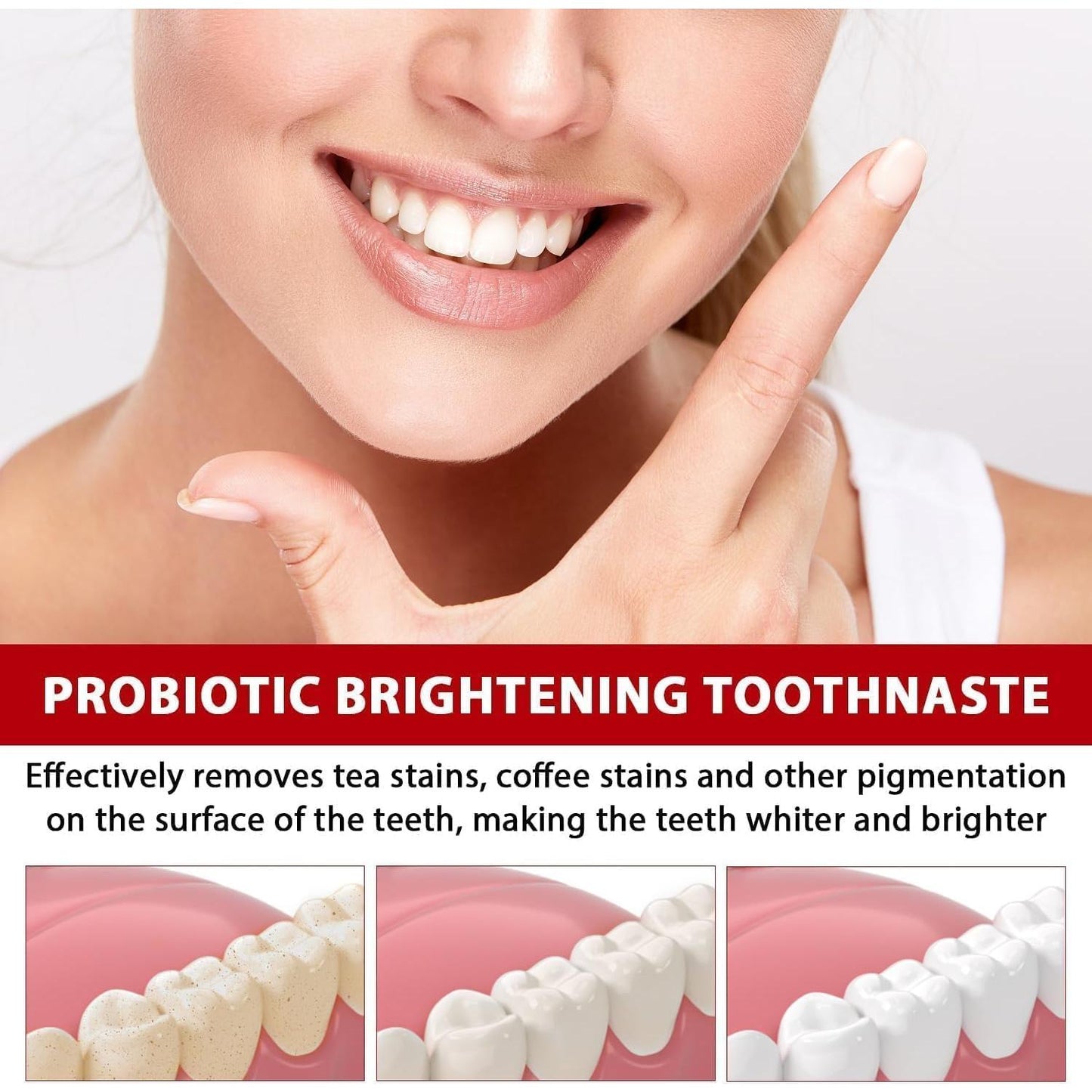 Sp-6 Ultra Whitening Toothpaste,Probiotic Sp-6 Toothpaste,SP 6 Toothpaste,Ultra Whitening Toothpaste Sp-6 (1pc)