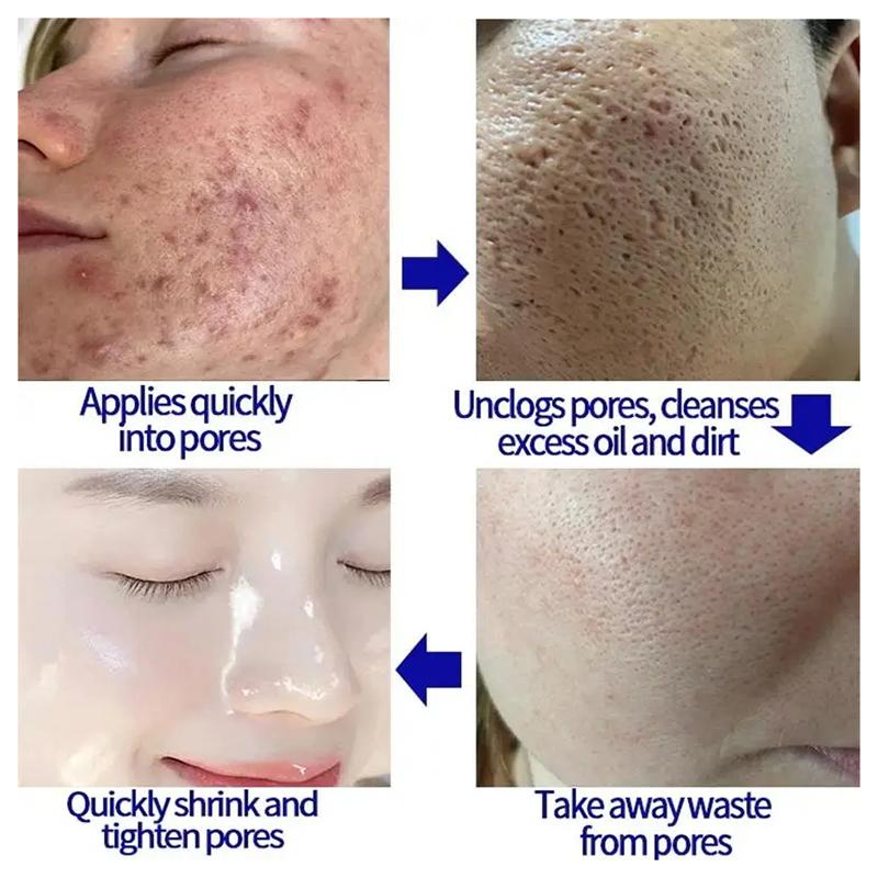 Salicylic Acid Pore Shrinking Cream Large Pores Tightening Repairing Serum Moisturizing Oil Control Skin Care Cosmetic 2024