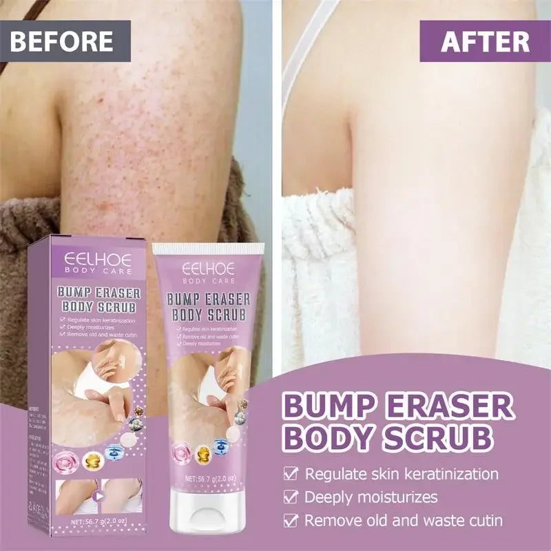 Body Scrub Mild Hair Follicle Keratinization Cream Removes Dead Skin Unblocks Pores Moisturizes Strawberry Legs Repairs Skin