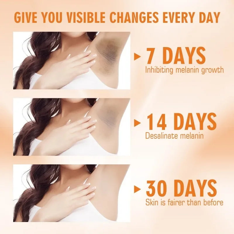 Brightening Knee Joints Armpits Cream Lightening Melanin Body Brighten Cream Moisturizing Smooth Skin Vitamin C Lotion Cream
