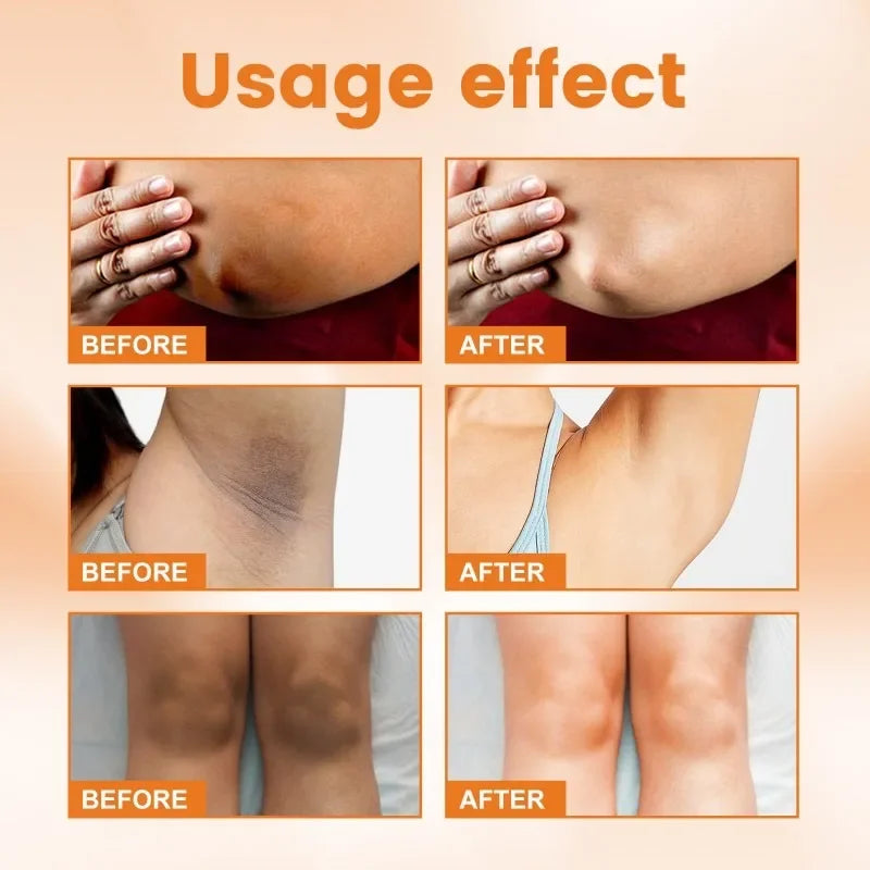 Brightening Knee Joints Armpits Cream Lightening Melanin Body Brighten Cream Moisturizing Smooth Skin Vitamin C Lotion Cream