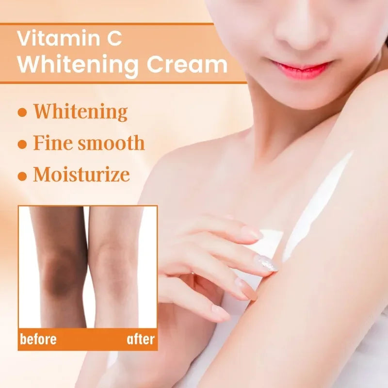 Brightening Knee Joints Armpits Cream Lightening Melanin Body Brighten Cream Moisturizing Smooth Skin Vitamin C Lotion Cream