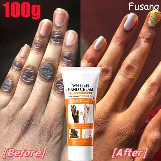 Dark Knuckles Fast Whitening Serum Anti Cracking Cream Pigmentation Correctors For Black Skin Intense Stains Remover Products