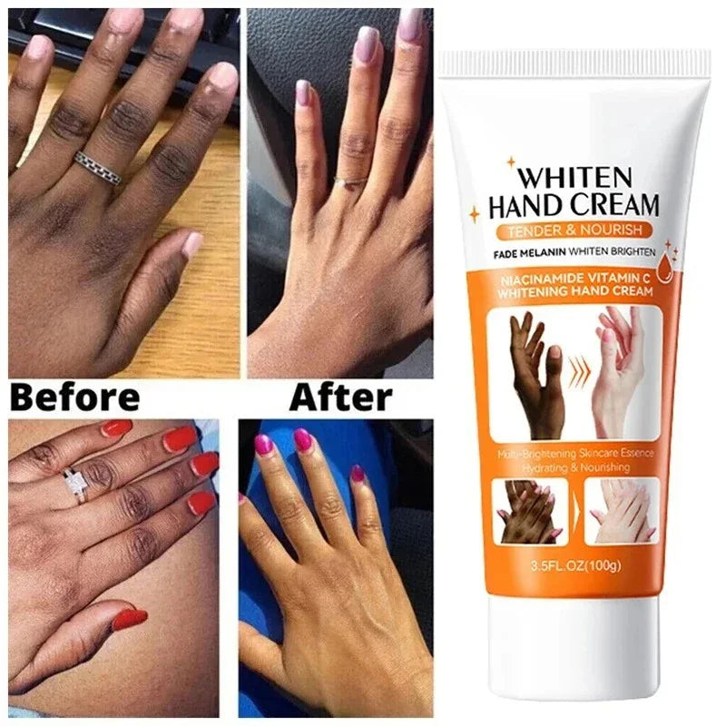 Dark Knuckles Fast Whitening Serum Anti Cracking Cream Pigmentation Correctors For Black Skin Intense Stains Remover Products