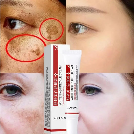 Effective Whitening Freckle Cream Anti-pigmentation Nourishing Fast Remove Melasma Dark Spot Fade Melanin Face Care Cream