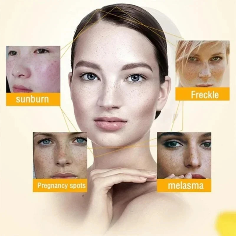 Effective Whitening Freckle Cream Anti-pigmentation Nourishing Fast Remove Melasma Dark Spot Fade Melanin Face Care Cream