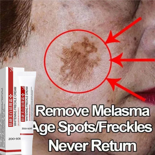 Face Melasma Cream Brighten Dark Skin Emulsion Lightening Melanin Brighten Cream For Dull Skin Women Moisturizing Products 2024