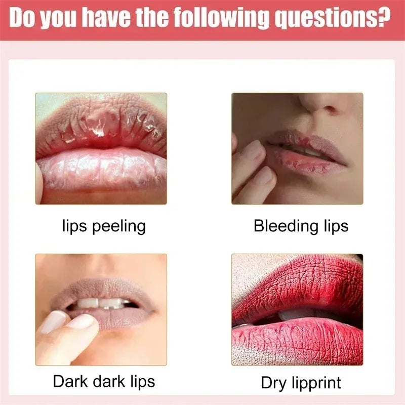 Fast Lightening Pink Mouth Lips Serum Bleaching Permanent Pinkish Moisturizing Lighten Dark Lip Balm Gloss Lipstick Lip Mask