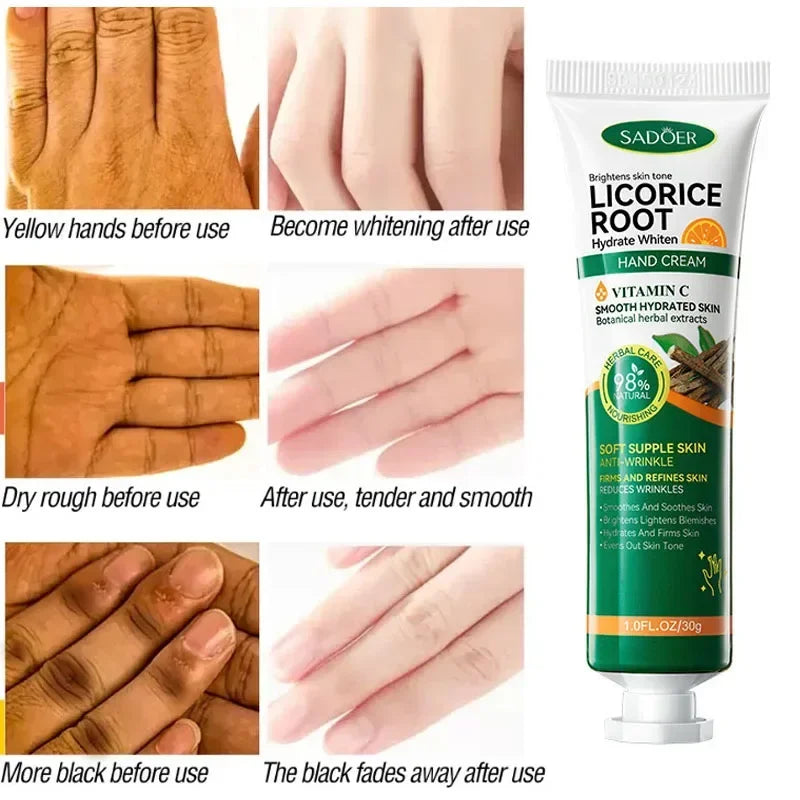 Fast Whitening Dark Knuckles Brighten Hand Cream Moisturizing Intense Stains Remover Melanin Corrector Products Skin Care 2024