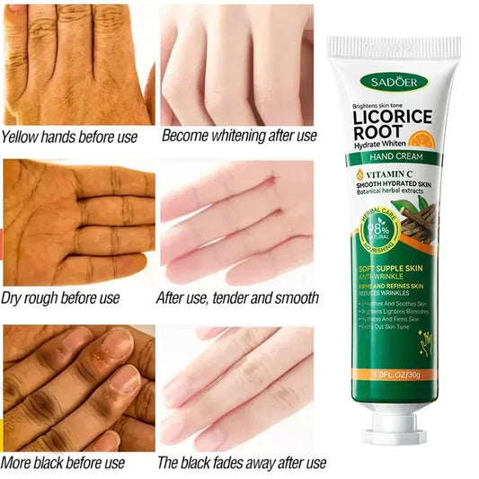 Fast Whitening Dark Knuckles Brighten Hand Cream Moisturizing Intense Stains Remover Melanin Corrector Products Skin Care 2024