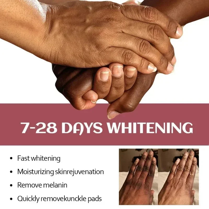Fast Whitening Dark Knuckles Brighten Hand Cream Moisturizing Intense Stains Remover Melanin Corrector Products Skin Care 2024