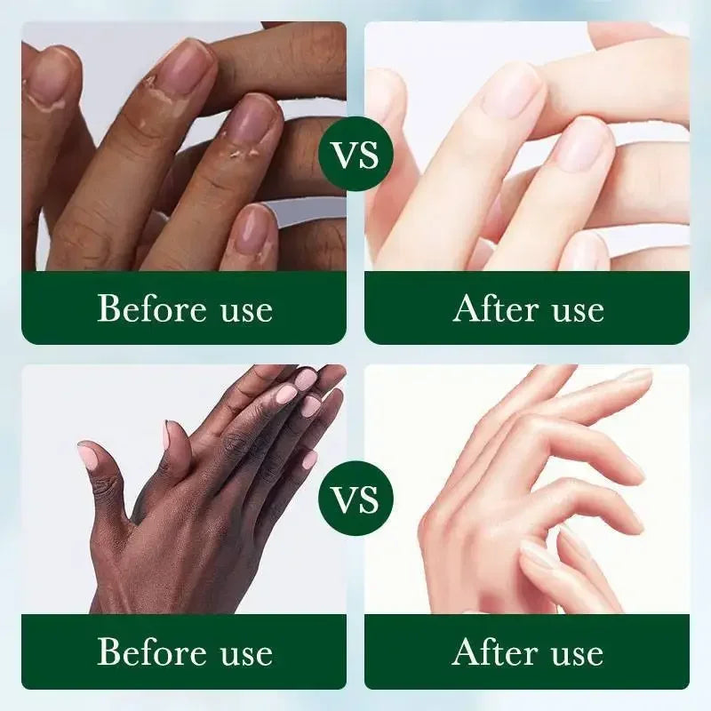 Fast Whitening Dark Knuckles Brighten Hand Cream Moisturizing Intense Stains Remover Melanin Corrector Products Skin Care 2024