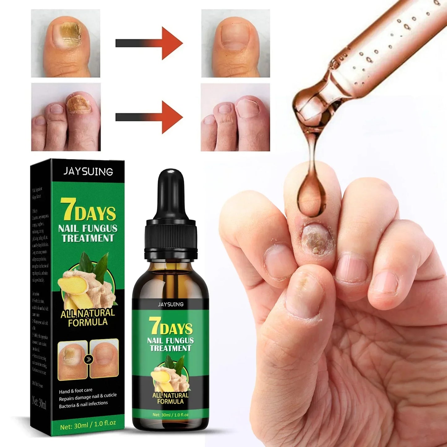 Fingernail Repair Nail Clean Laser Device Cold Laser Therapy Nail Fungus Treatment Physical Therapy Onychomycosis Foot product