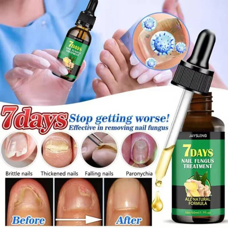 Fingernail Repair Nail Clean Laser Device Cold Laser Therapy Nail Fungus Treatment Physical Therapy Onychomycosis Foot product
