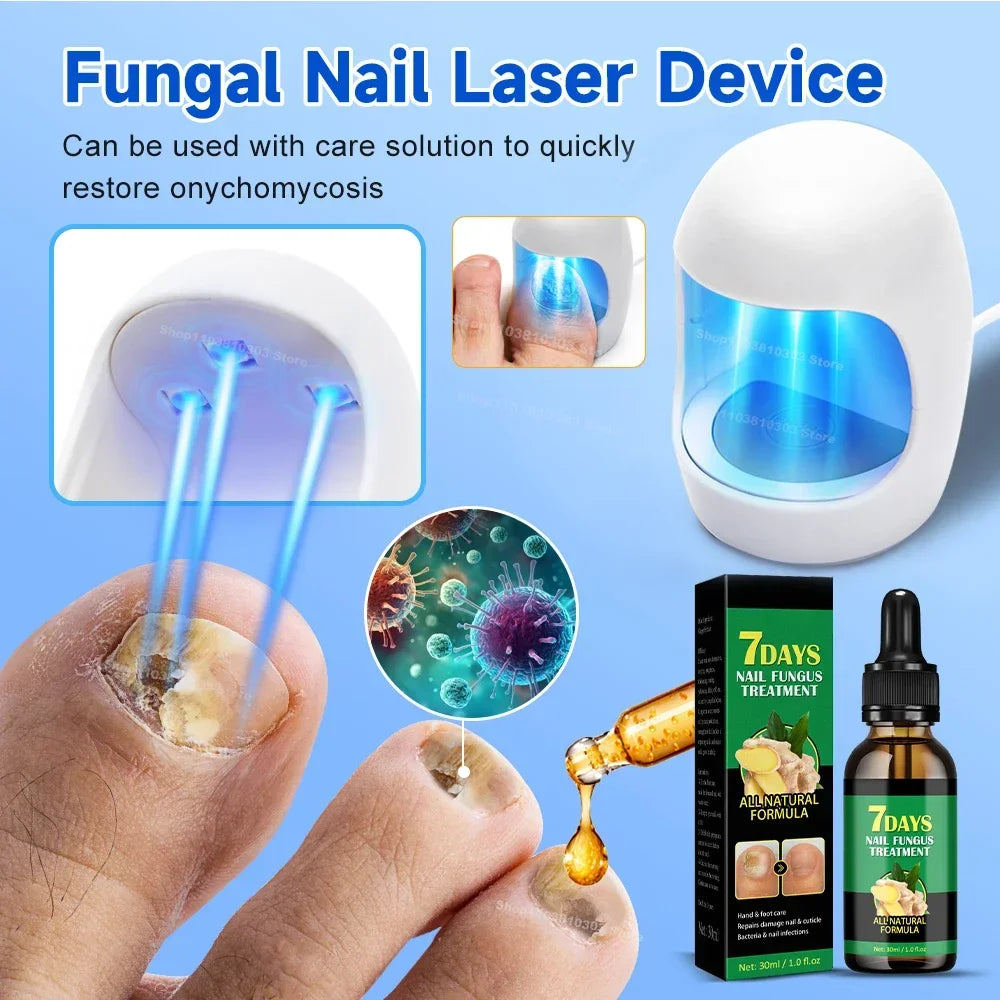 Fungal Nail Laser Device Repair Fast Onychomycosis Fungus Nails Toenail for Foot Nail Fungus Essential Oil Nail Treatment