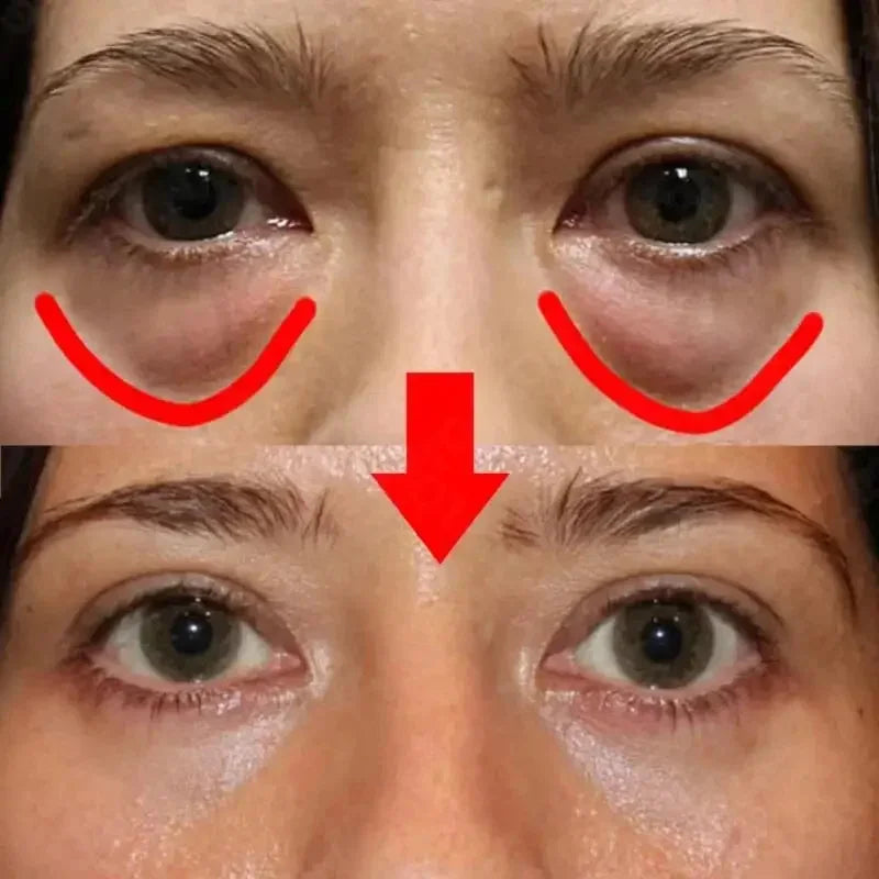 Instant Eye Bag Removal Cream Collagen Removal Wrinkles Firming Skin Fade Fine Lines Brighten Dark Circle Anti Puffiness Korean