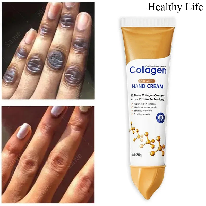 Kojic Acid Fade Dull Hand Cream Body Fast Smooth Nourish Cream Lightening Black Skin Brightening Moisturizing Korean Skin Care