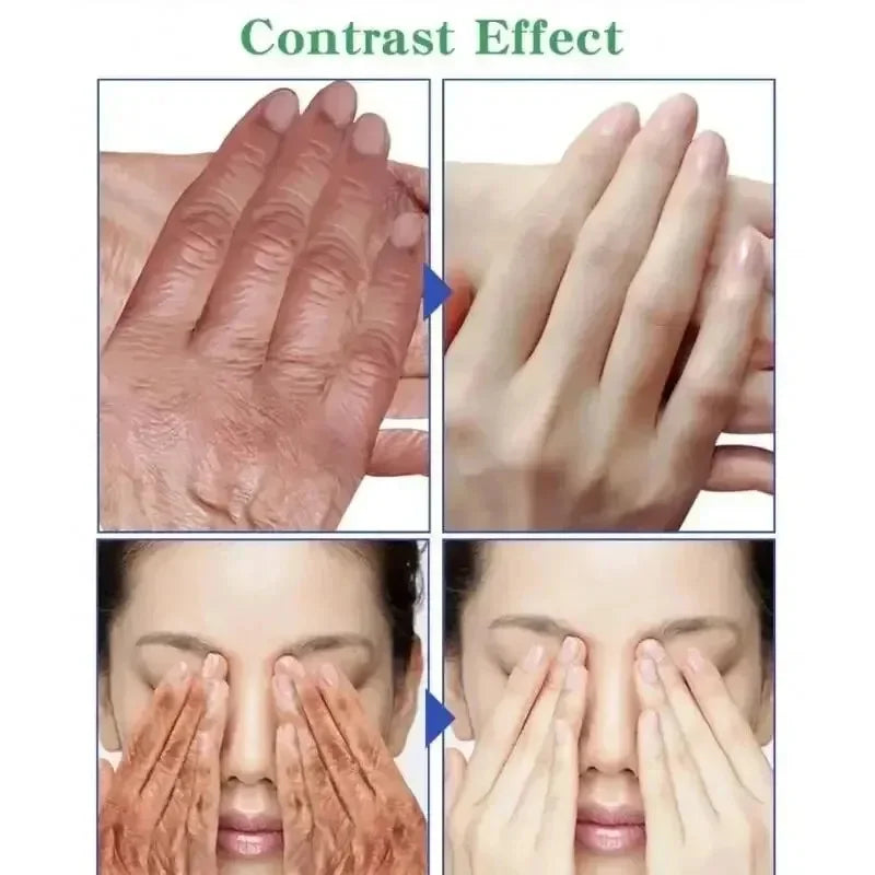 Kojic Acid Fade Dull Hand Cream Body Fast Smooth Nourish Cream Lightening Black Skin Brightening Moisturizing Korean Skin Care