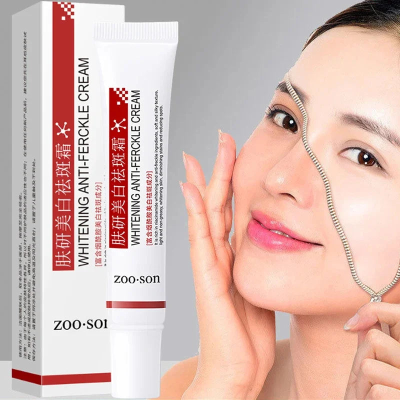 Powerful Spot-removing Whiten Cream Brighten Skin Fast Eliminates Melanin Pigmentation Melasma Dark Spots Moisturize Beauty Gel