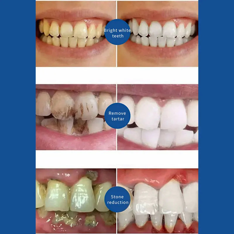 Probiotic Toothpaste SP-4 Whitening Tooth Remove Plaque Stains Teeth Whitener Oral Hygiene Clean Fresh Breath Dental Tools 2024