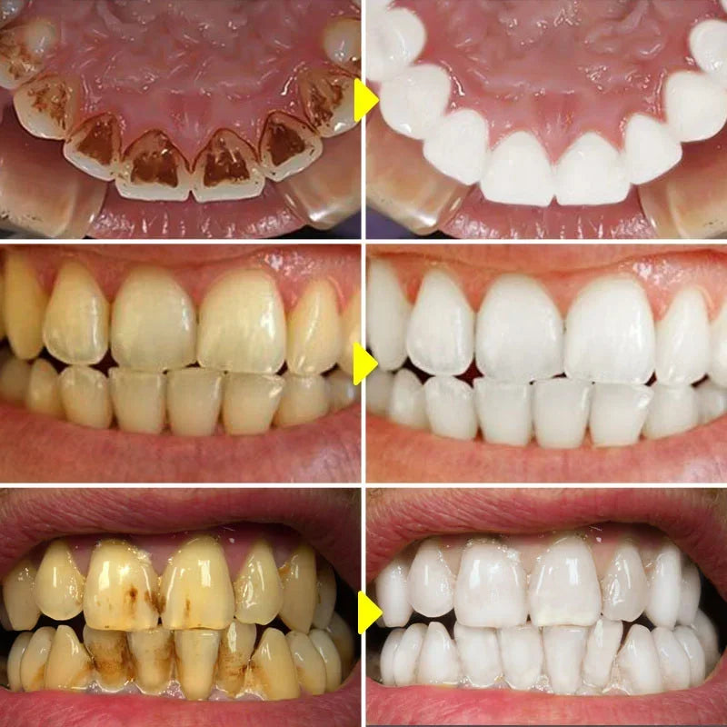 SP-6 Probiotic Toothpaste Whitening Tooth Remove Plaque Stains Teeth Whitener Oral Hygiene Clean Fresh Breath Denta 120g New