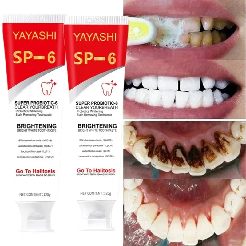 SP-6 Probiotic Toothpaste Whitening Tooth Remove Plaque Stains Teeth Whitener Oral Hygiene Clean Fresh Breath Denta 120g New