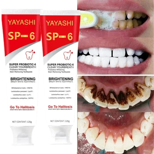 SP-6 Probiotic Toothpaste Whitening Tooth Remove Plaque Stains Teeth Whitener Oral Hygiene Clean Fresh Breath Denta 120g New